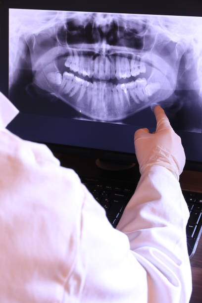 Best Emergency Root Canal Treatment in Moss Beach, CA