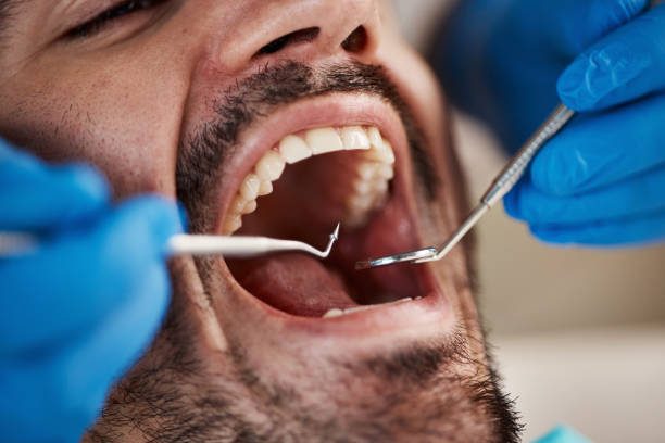 Best Pediatric Emergency Dentist in Moss Beach, CA
